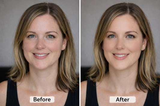 Blemish/ Capillary Concealer