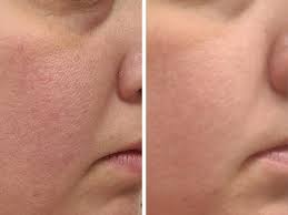 Custom Face Cream mixed by a Licensed Esthetician!